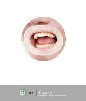 SEPARADOR DE LABIOS CON BARRERA DE GOMA